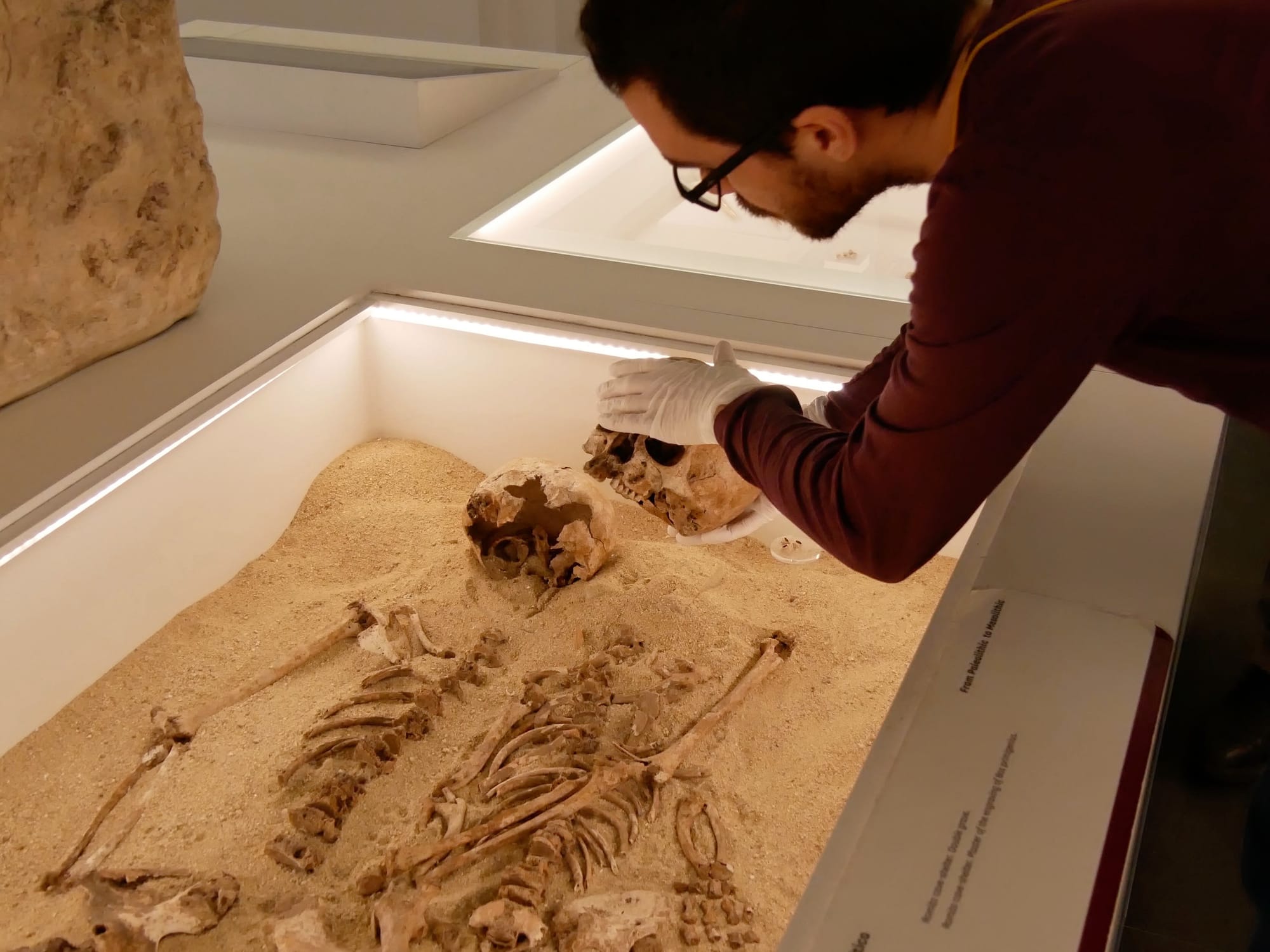 Scoperta la malattia genetica più antica del mondo: risale a 12 mila anni fa